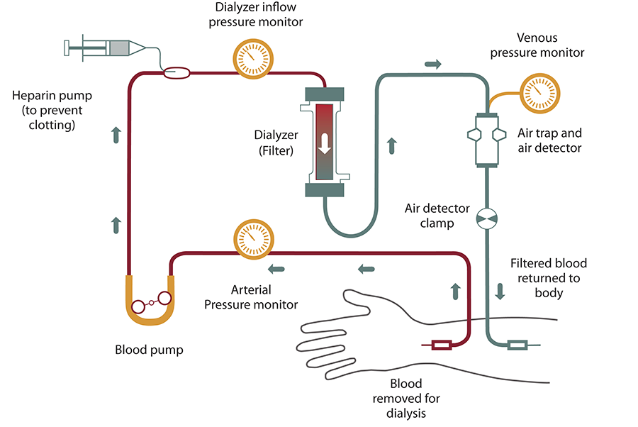 dialysis-process